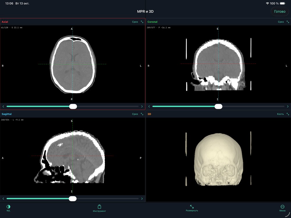 MPR: cuatro vistas en iPad