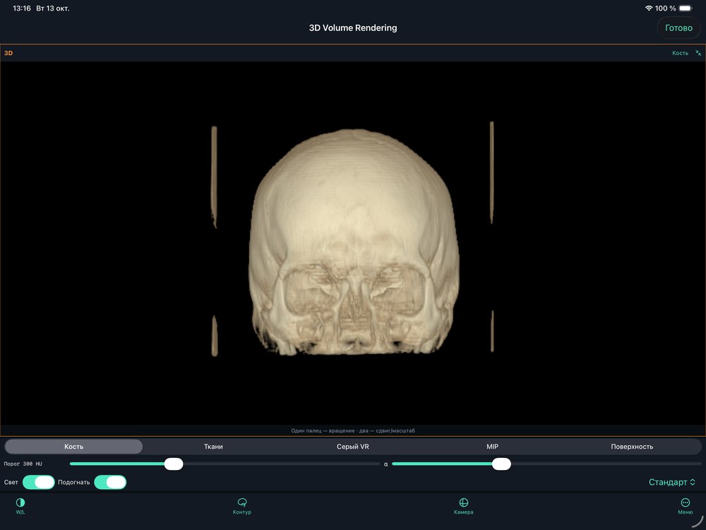 Volume Rendering: Hueso